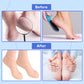 Winter's Foot Moisturizing Silicone Socks